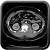 Compression médullaire sur Burst fracture de L1 TAP Axial Artériel