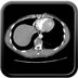 Fracture instable de T12 en hyperflexion associant fracture tassement corporéal, fracture - luxation bilatérale des massifs articulaires et lésions disco-ligamentaires inter épineux, sur épineux et du ligament jaune. TAP Axial artériel