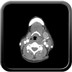 Phlegmon périamygdalien gauche  TDM Cou Axial Produit : Iode