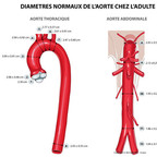 Anatomie de l’aorte diametres-normaux-de-l'aorte Anatomie de l’aorte diametres-normaux-de-l'aorte
