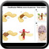 Cancer du pancreas  classification-tnm-cancer-du-pancreas