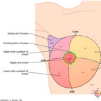 Breast cancer quadrants-of-the-breast-cancer Breast cancer quadrants-of-the-breast-cancer