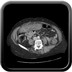 Colite infectieuse Axial