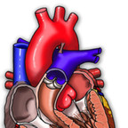 Arrhythmogenic Right Ventricular Cardiomyopathy/Dysplasia ARVD-mcKenna-Arrhythmogenic-Right-Ventricular-Cardiomyopathy-Dysplasia---- Arrhythmogenic Right Ventricular Cardiomyopathy/Dysplasia ARVD-mcKenna-Arrhythmogenic-Right-Ventricular-Cardiomyopathy-Dysplasia----