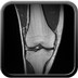 bipartite patella  MRI Lower limb Coronal T1w