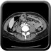 Tuberculose sacrée avec volumineux abcès Abdomen portal axial