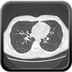 Déficit immunitaire commun variable : micronodules centrolobulaires sur bronchiolite  TDM Thorax Axial Fenêtre Air