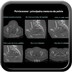 Dimensions du pelvis en obstétrique Pelvimétrie-pelviscanner-dimensions-normales-du-pelvis-en-obstétrique