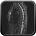 Sternite  IRM Thorax Sagittal